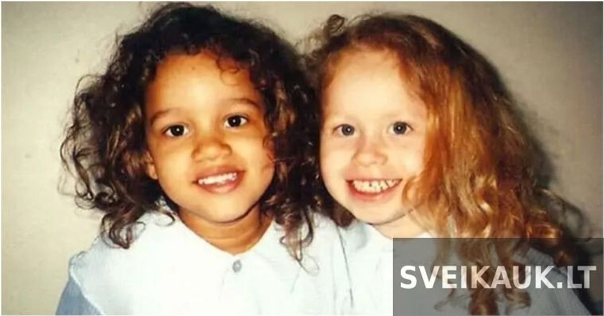 Dvynės, gimusios su skirtinga odos spalva, užaugo: kaip atrodo 24 metų gražuolės
