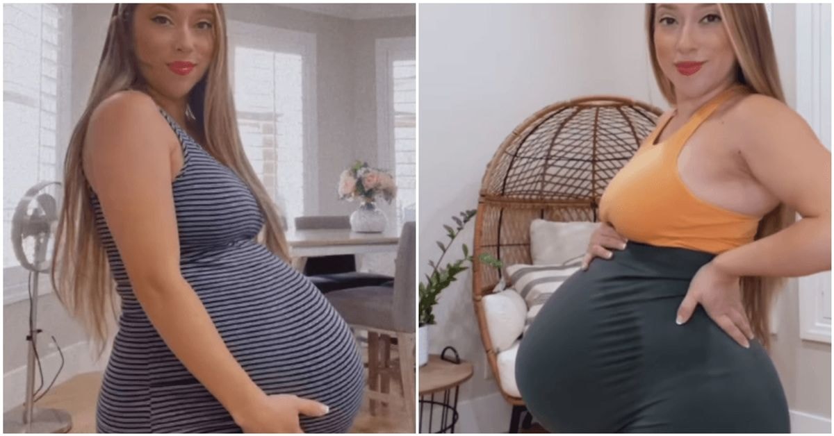 Nėščiosios pilvas nenustojo augti, todėl niekas netikėjo, kad ji laukėsi tik vieno vaiko