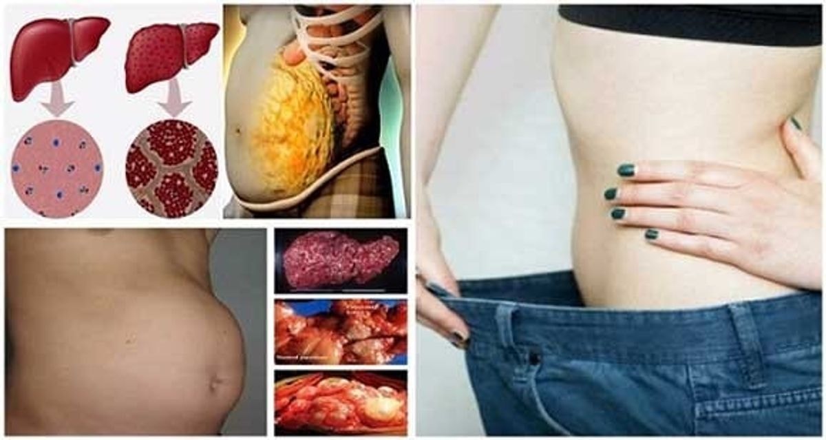 Pašalinkite toksinus iš savo kūno ir praraskite 5 kg svorio vos per 2 naktis!