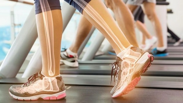 Užkerta kelią osteoporozei