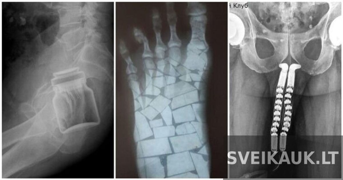 Įsimintinos rentgeno nuotraukos, kurių gydytojai nepamirš dar ilgą laiką