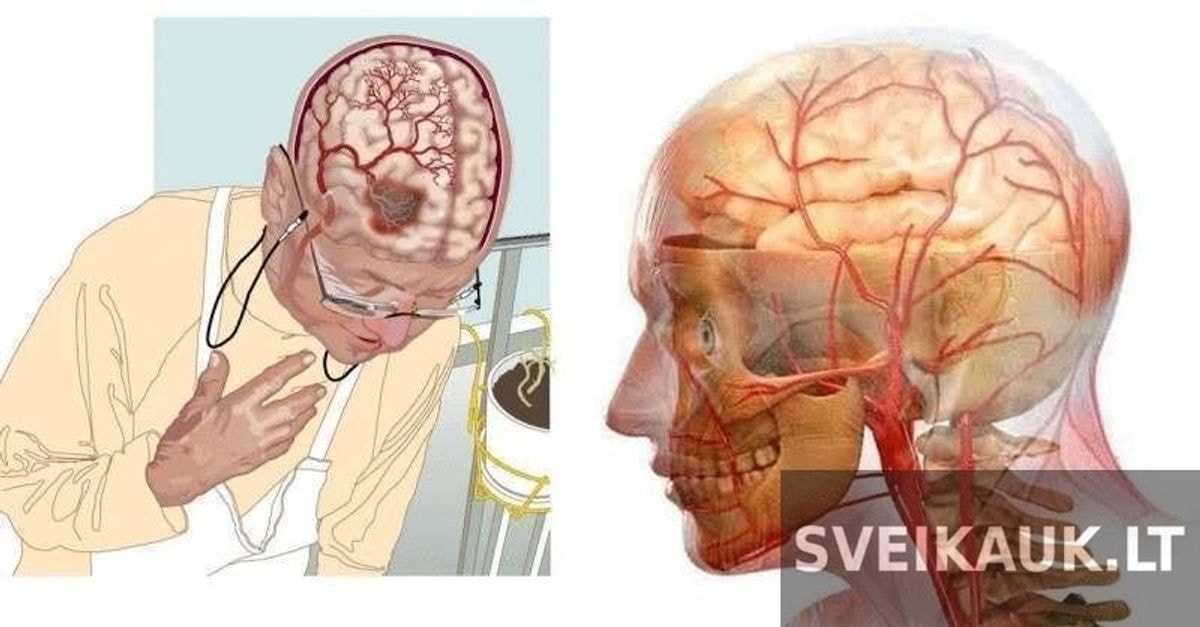 3 naudingiausi receptai, padedantys pagerinti kraujotaką smegenyse!