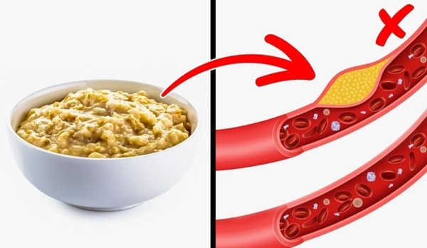 Sumažinkite cholesterolio kiekį