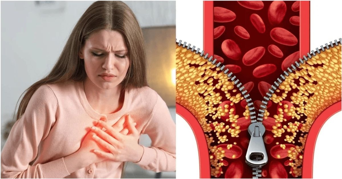 Ką gerti ir ko vengti, jei cholesterolio kiekis padidėjęs