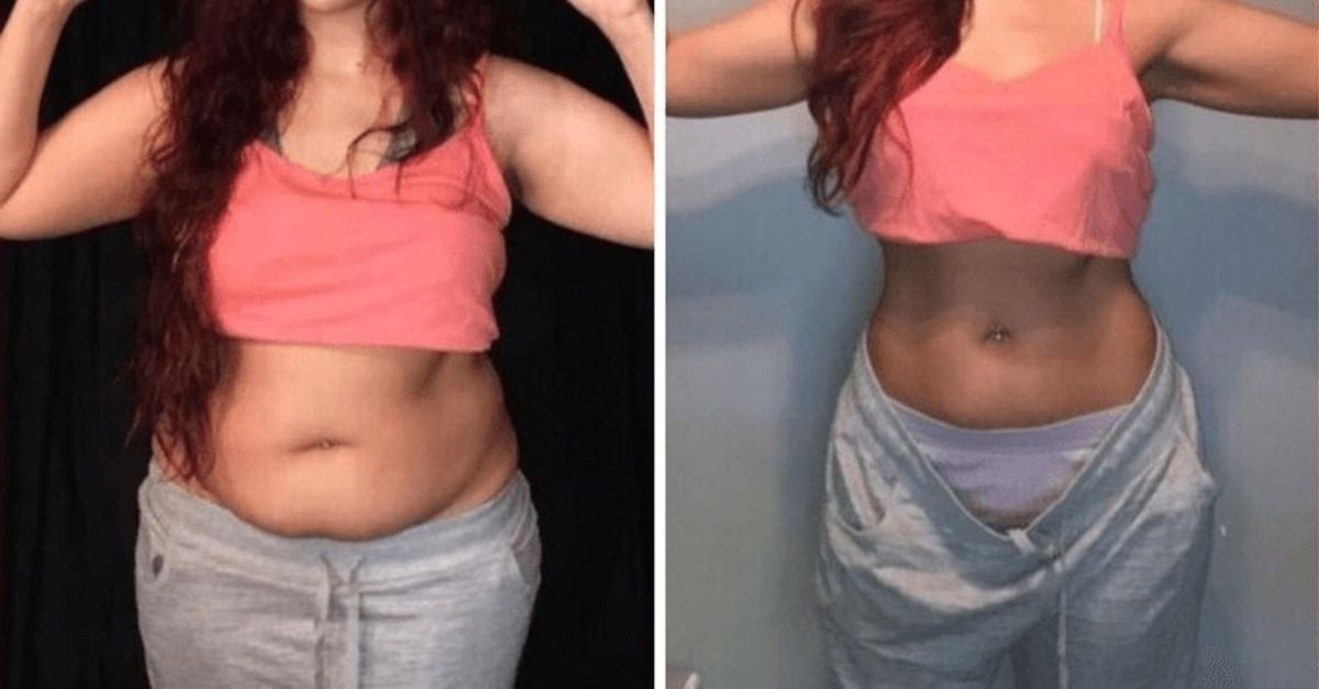 Kaip atsikratyti suglebusio pilvo be alinančių dietų ir intensyvių treniruočių?