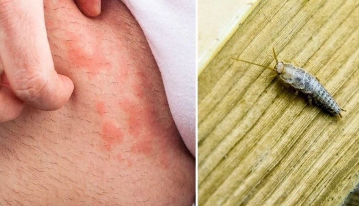 Šis Parazitas Siurbia Žmonių Kraują: Puola Naktį