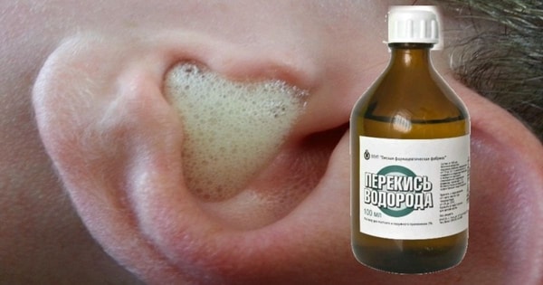 nuotrauka