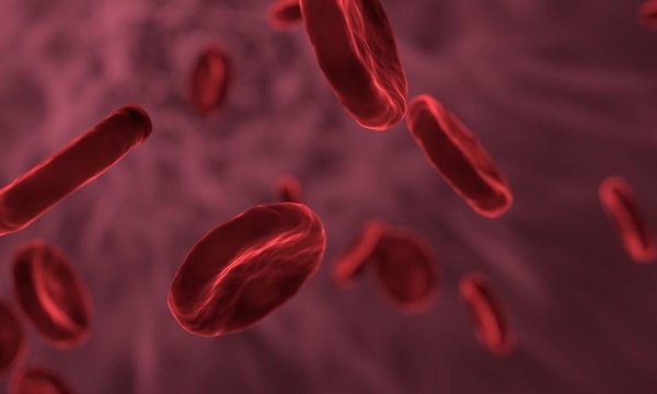 sumažina cholesterolio kiekį