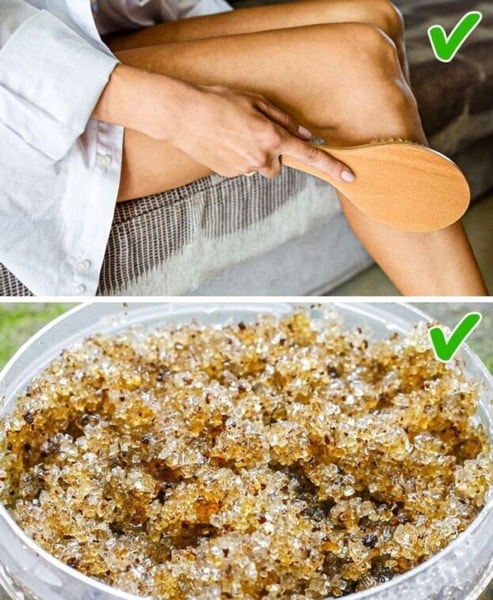 nuotrauka