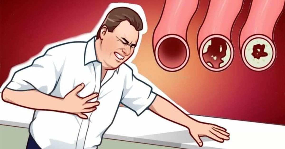 maisto produktai, mažinantys cholesterolio kiekį