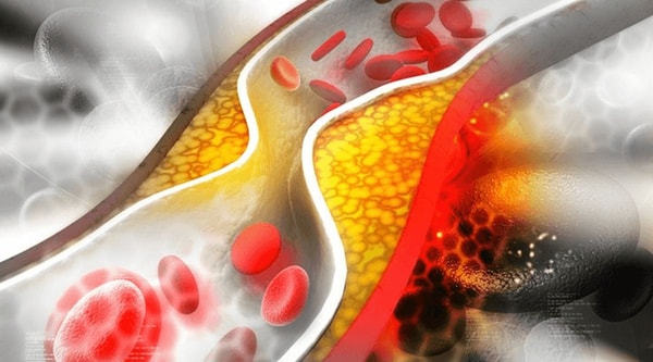 Reguliuoja cholesterolio kiekį