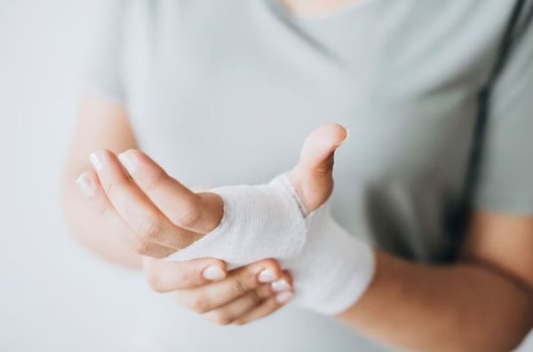 woman with injured hand