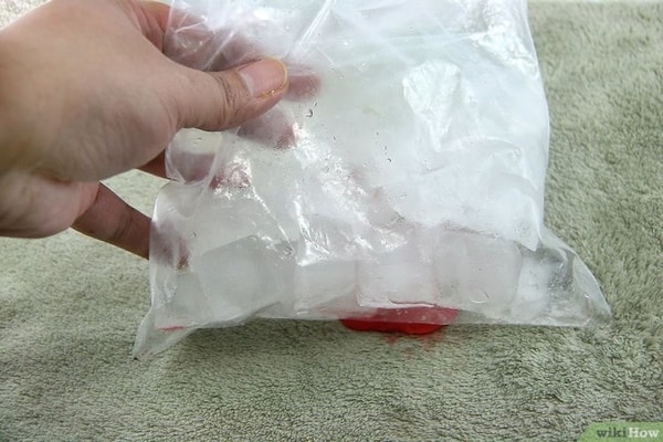 nuotrauka