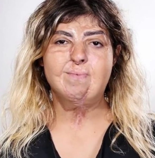 nuotrauka