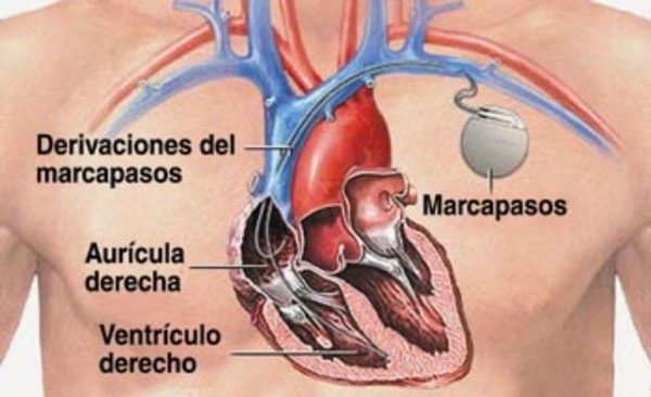 nuotrauka