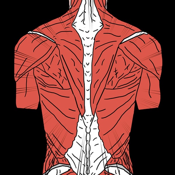 Fibromialgija
