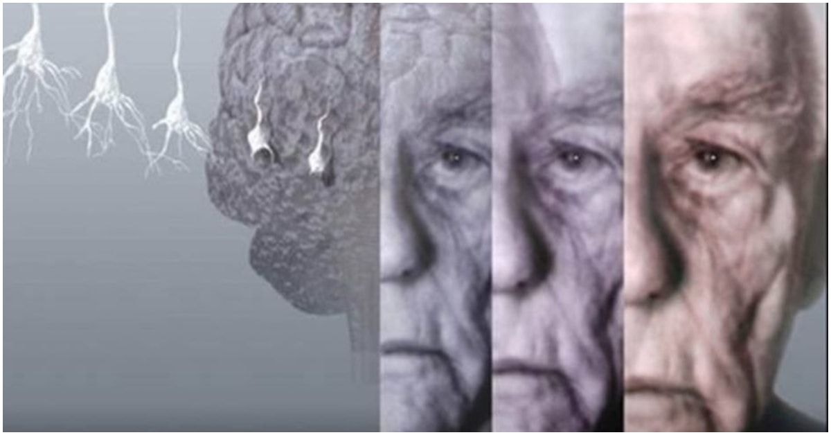 alzheimerio ligos grėsmė