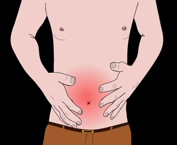 Gastroezofaginio refliukso liga