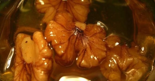 nuotrauka