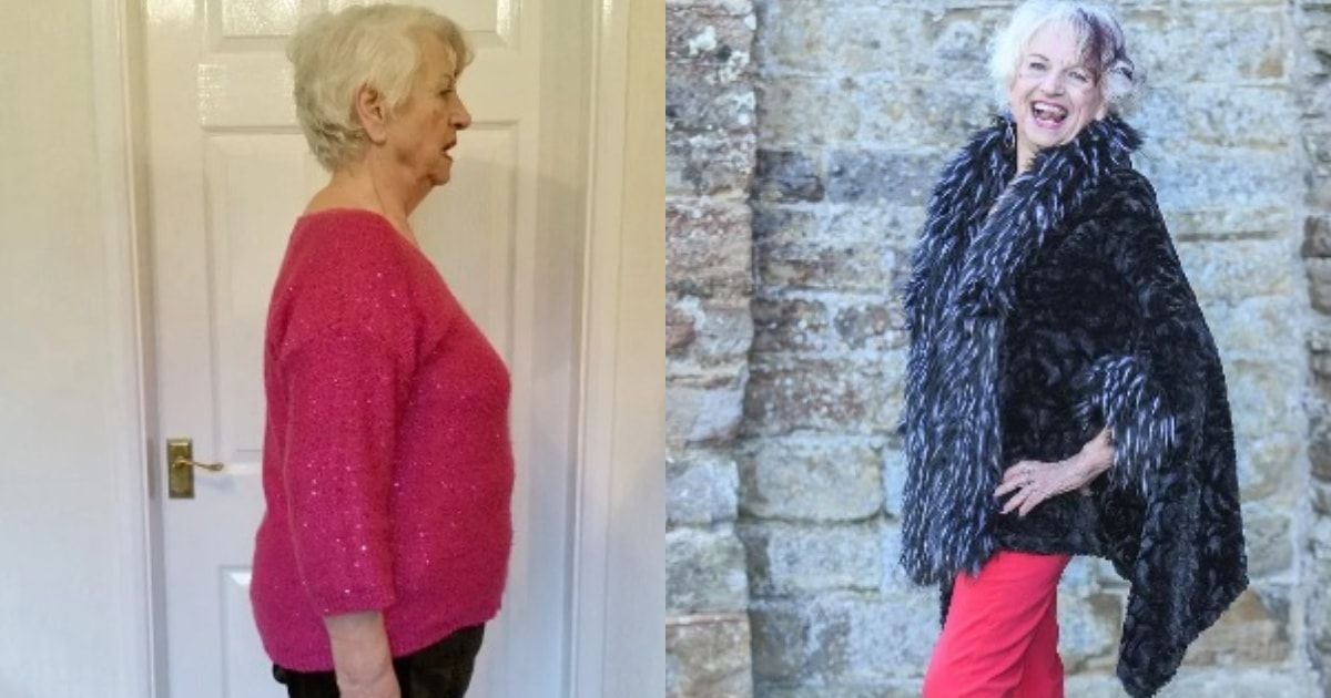 Moteris numetė 20 kilogramų iš meilės 84 metų partneriui