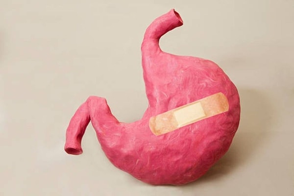 stomachillustration