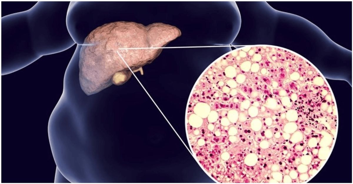 svarbus vitaminas kepenims