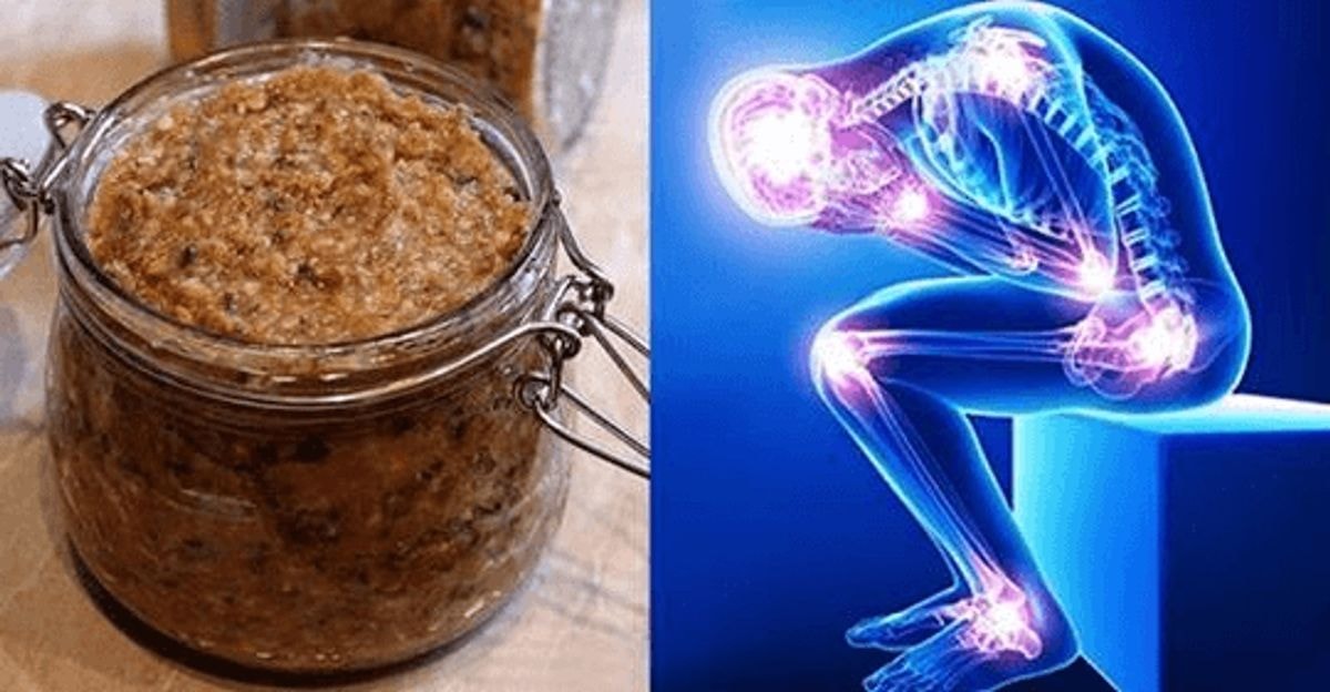 Šis vitaminų kompleksas padės visam laikui pašalinti skausmą keliuose