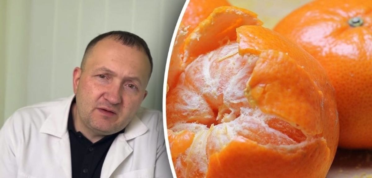 Kas nutiks, jei suvalgysite kilogramą mandarinų? Gydytojo atsakymas gali nustebinti