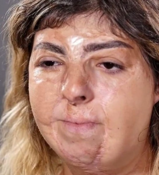 nuotrauka