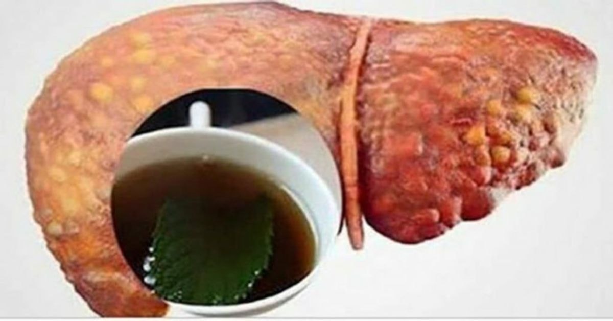 gėrimai išvalys kepenis