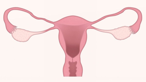 Jei kankina menstruacijų skausmai