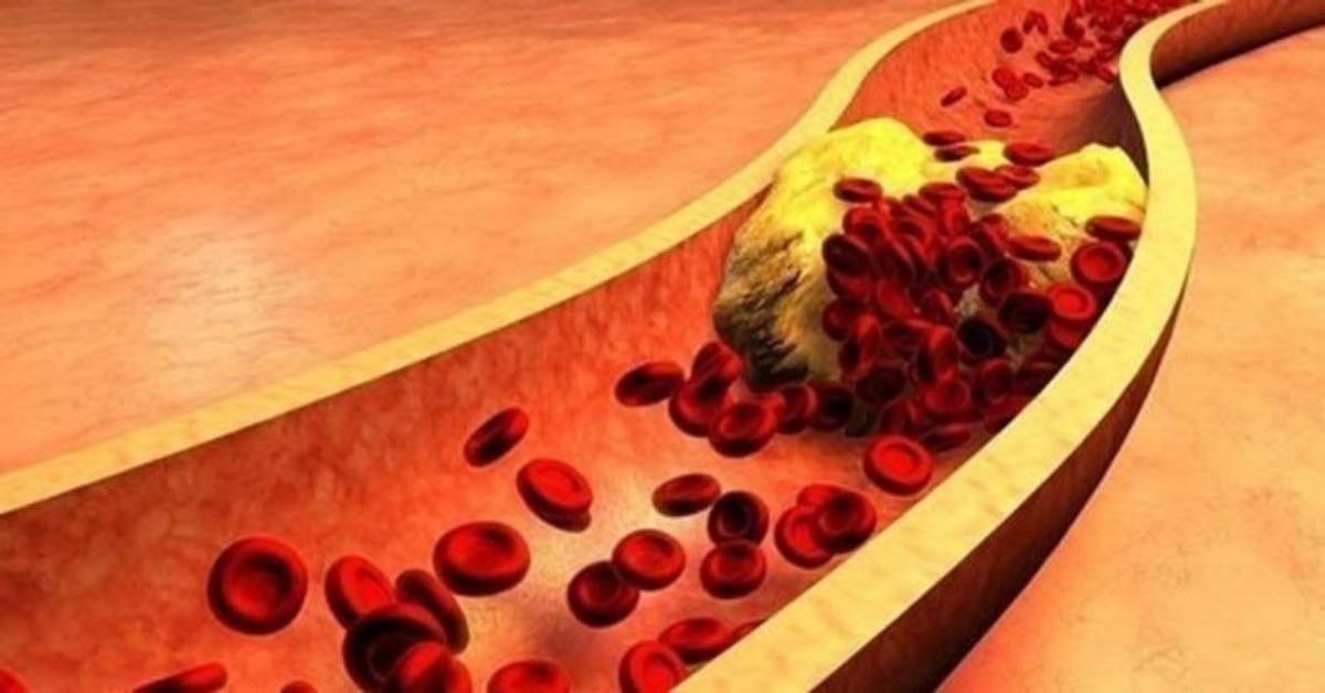 maisto produktai nuo cholesterolio