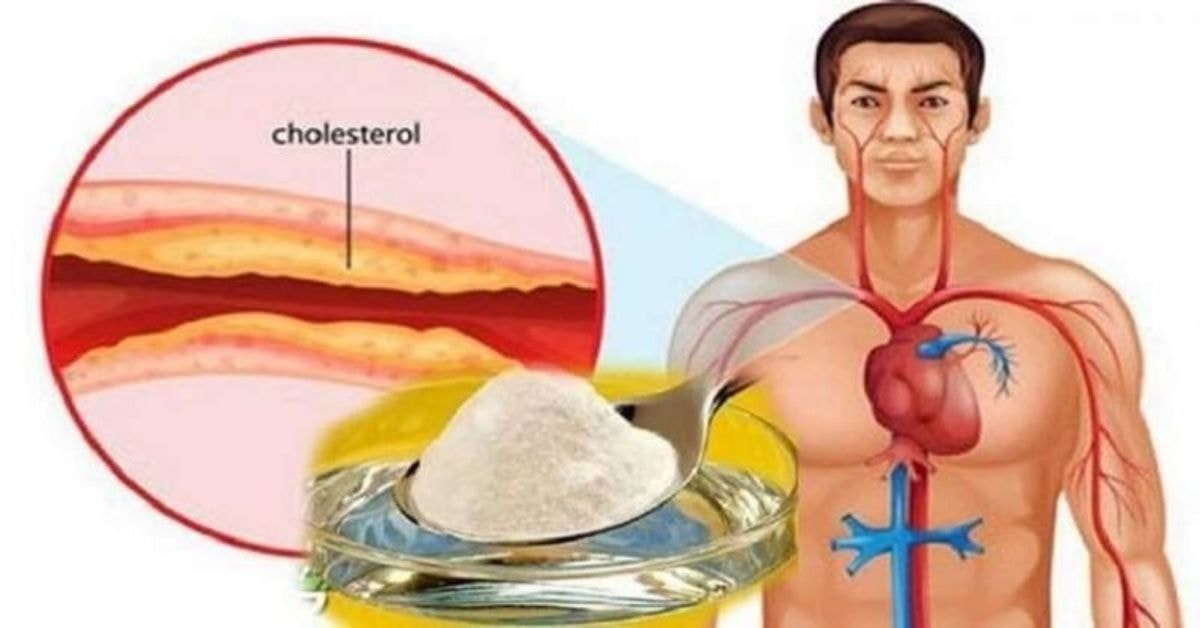 natūralus vaistas nuo cholesterolio