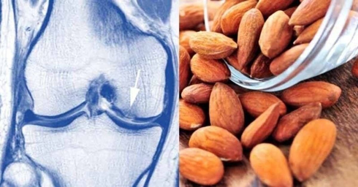 produktai padeda atkurti kremzlių audinį