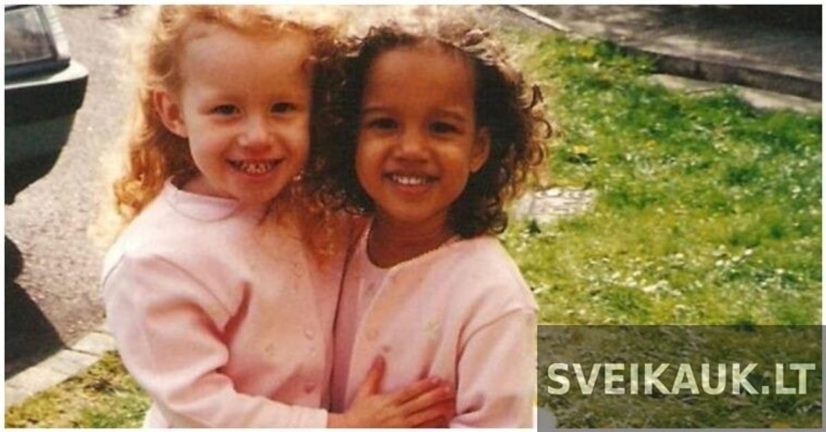 Dvynės mergaitės gimė su skirtinga odos spalva. Dabar joms 23 metai. Štai kaip jos atrodo