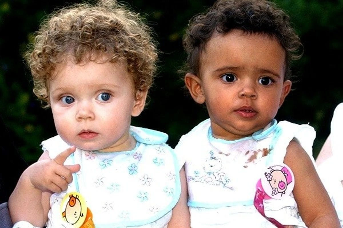 Dvynės mergaitės gimė 1997 metais su skirtinga odos spalva. Dabar joms 22 metai. Ir štai kaip susiklostė jų gyvenimas dabar
