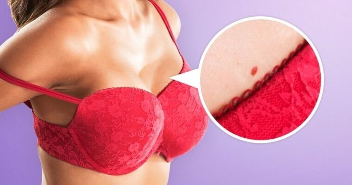 Ką reiškia šie raudoni taškeliai ant jūsų odos?
