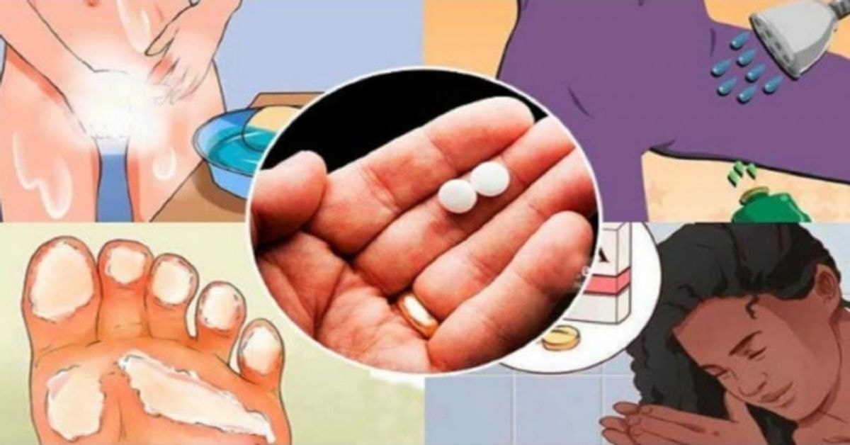 10 triukų su aspirinu, kuriuos kiekviena moteris privalo žinoti