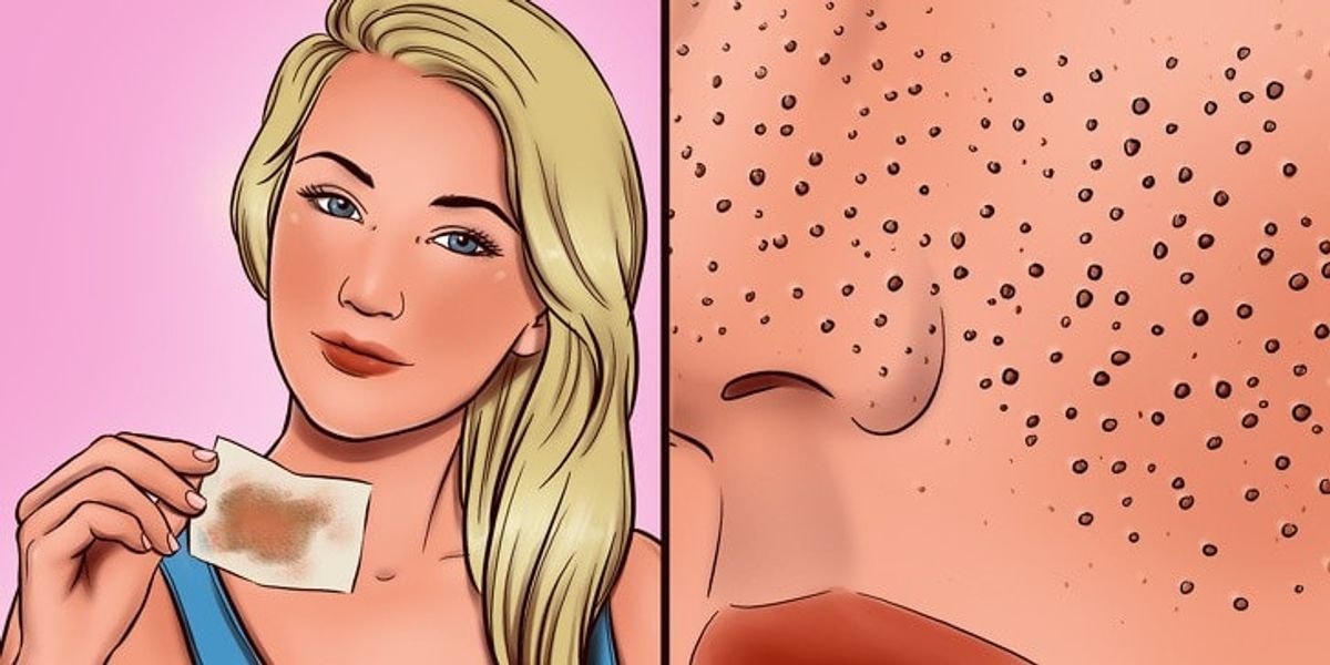 8 odos priežiūros klaidos, dėl kurių jūsų poros atrodo didesnės