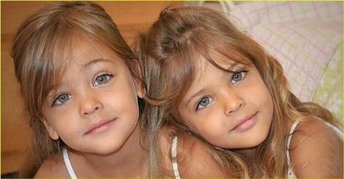 Būdamos 7 metų, dvynės buvo tituluojamos gražiausiomis merginomis pasaulyje. Taip jos atrodo dabar