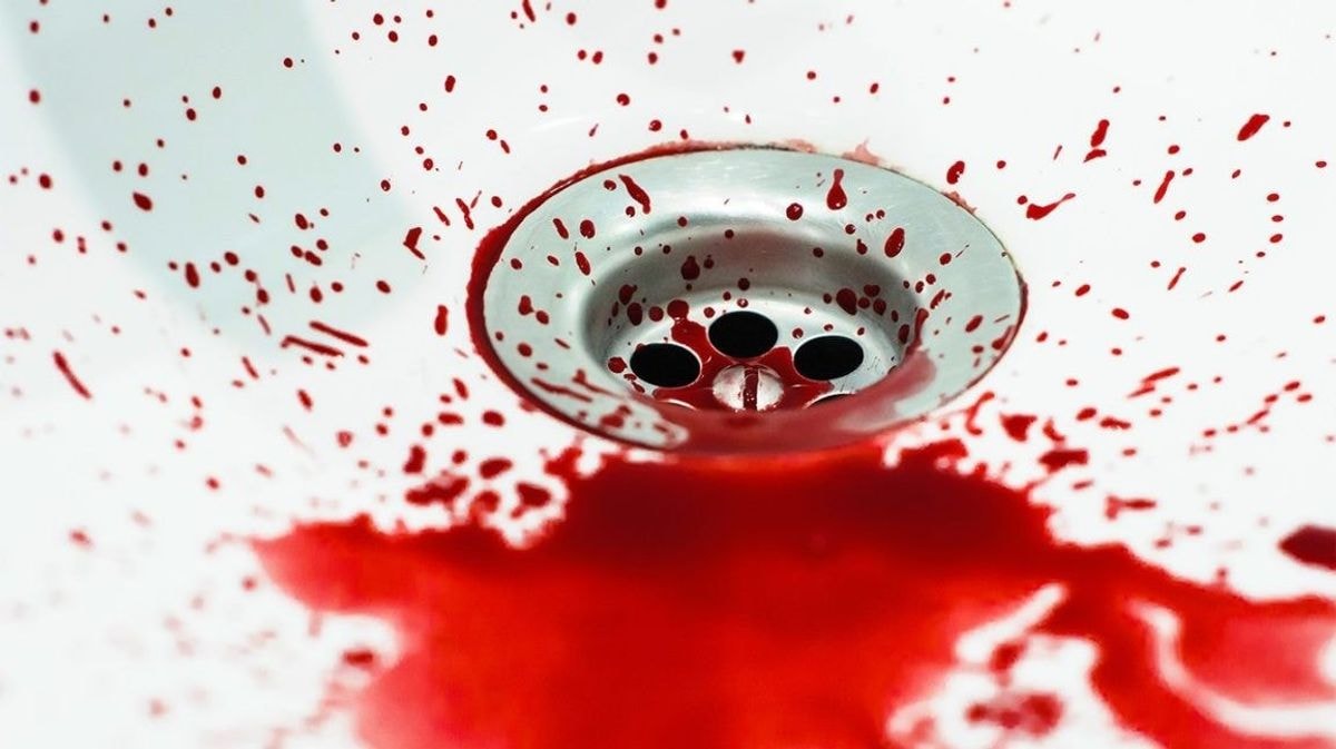Ką reiškia, jeigu susapnuojate kraują?