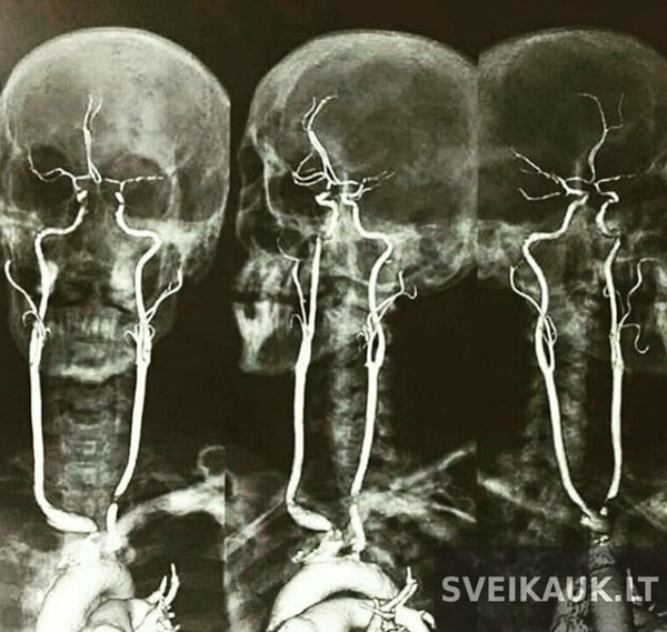 rentgeno nuotraukos 13
